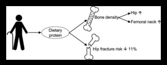 Diētas ar augstu olbaltumvielu saturu un kaulu veselība: mūža perspektīva